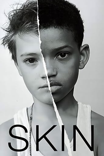 Skin 2018 (پوست)