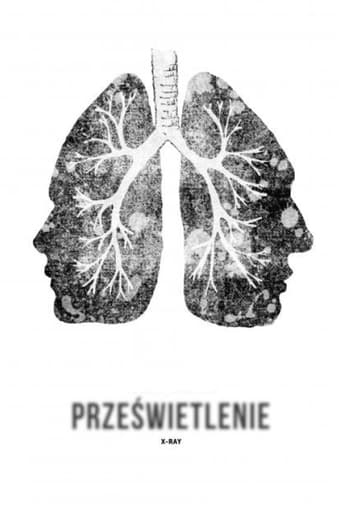 X-Ray 1974